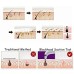 Derma Suction 4 In 1 Multi-Function Blackhead