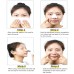 Derma Suction 4 In 1 Multi-Function Blackhead